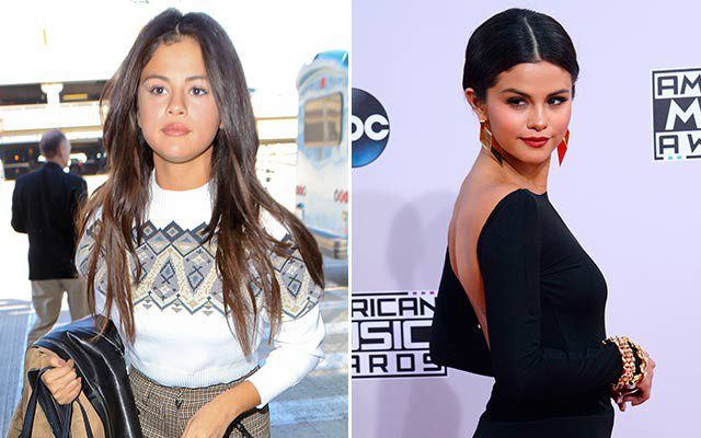 Selena-Gomez-cambio-facial