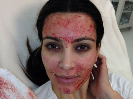 Los 10 tratamientos de belleza más asquerosos del mundo