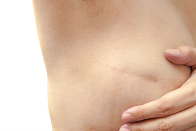 La detección precoz es muy importante (Foto: iStock)