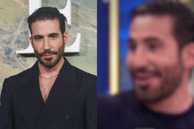 Esta es la nueva cara de Miguel Ángel Silvestre: ¿Qué se ha hecho?